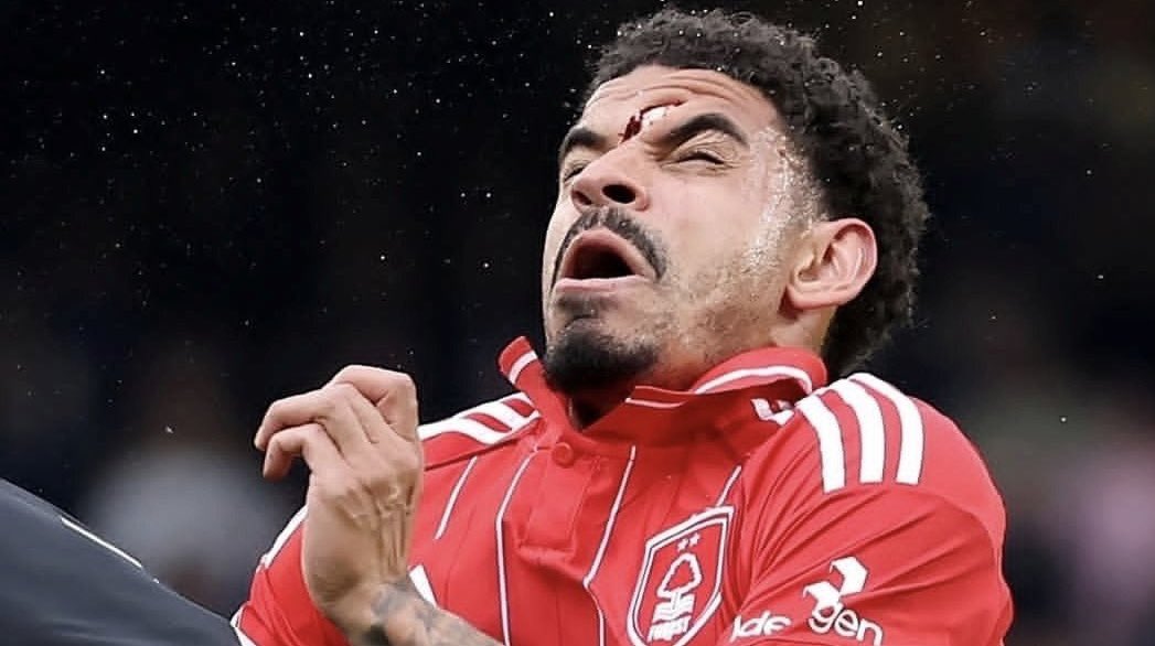 “He Should Have Played”: Forest Fans Rage Over Gibbs-White’s Absence in Semi-Final Disaster